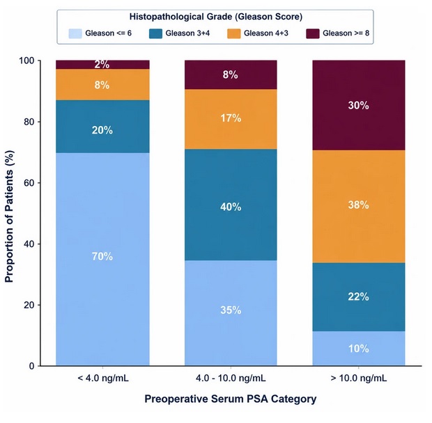 Association Between Preoperative Serum Prostate-Specific Antigen Levels and Gleason Score in Patients Undergoing Radical Prostatectomy for Prostate Adenocarcinoma
